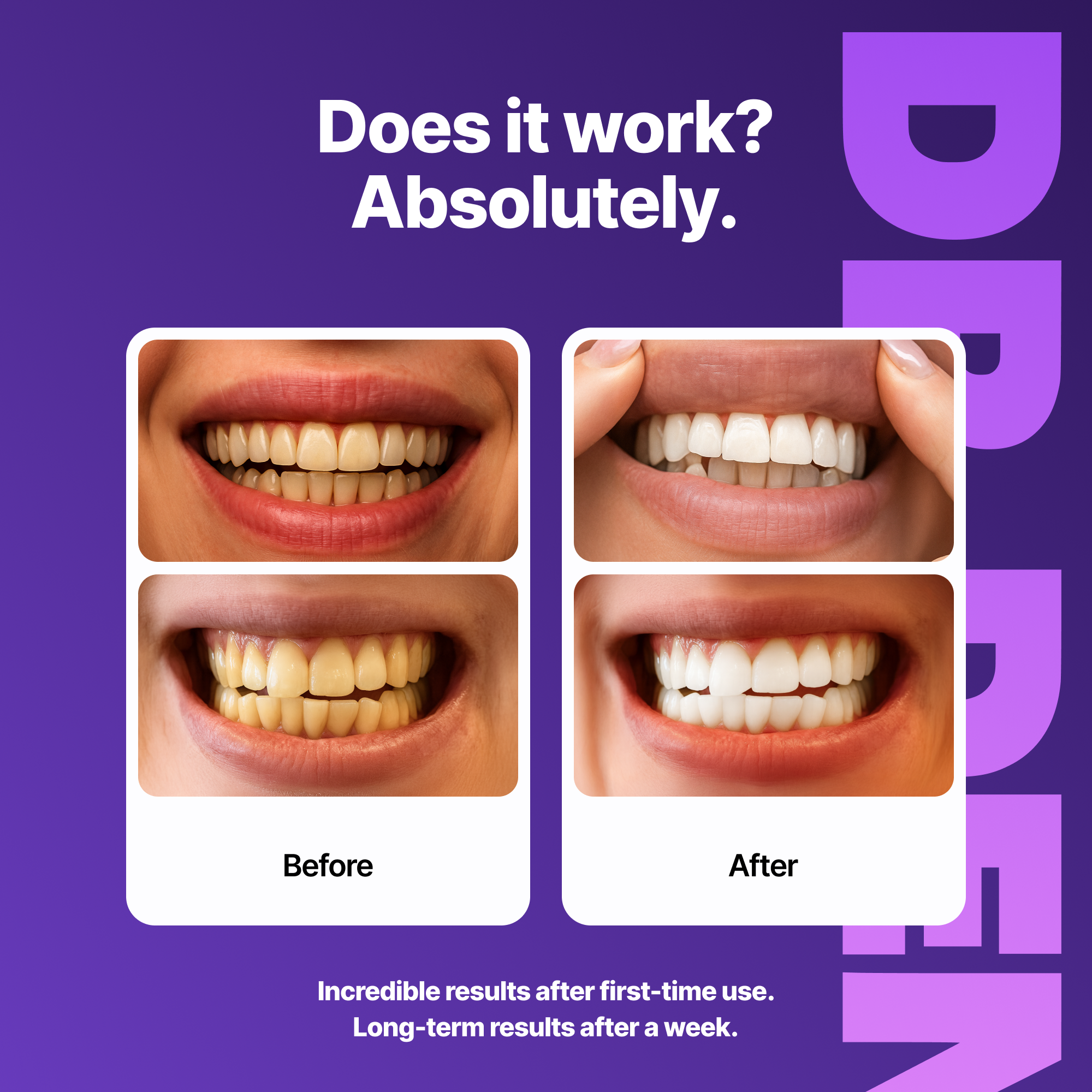 Purple Whitening Strips