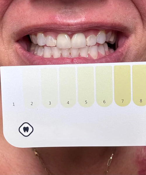 Customer using Dr.Smile