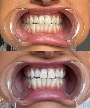 Customer using Dr.Dent