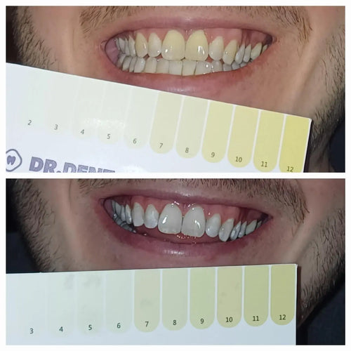 Customer using Dr.Smile
