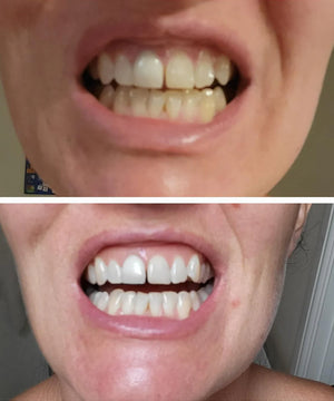 Customer using Dr.Dent