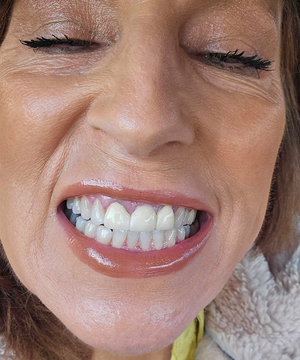 Customer using Dr.Dent