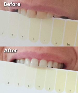Customer using Dr.Dent