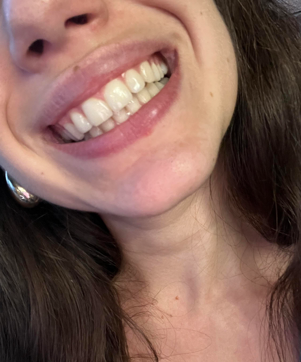 Customer smile result