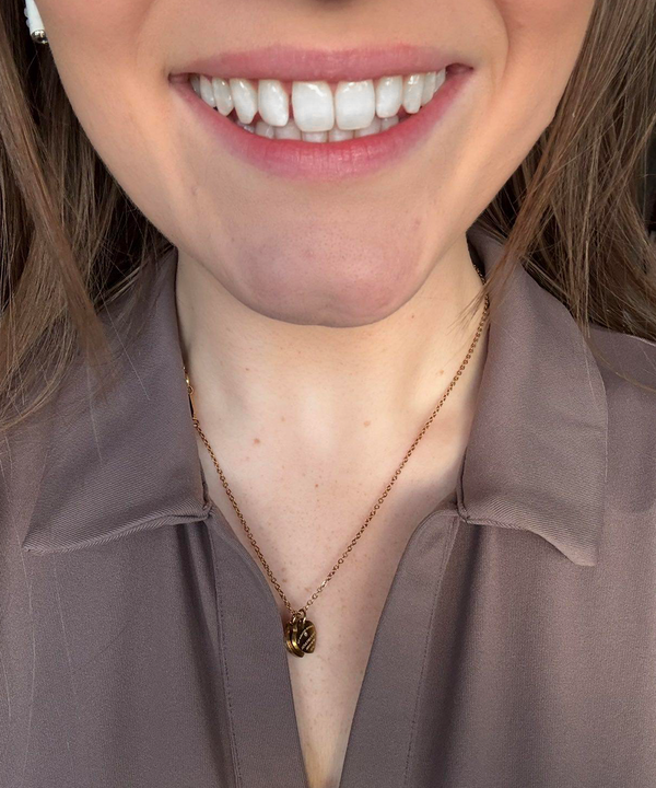 Customer smile result