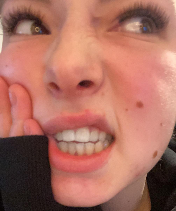 Customer smile result