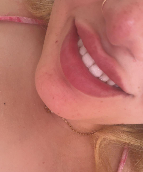 Customer smile result