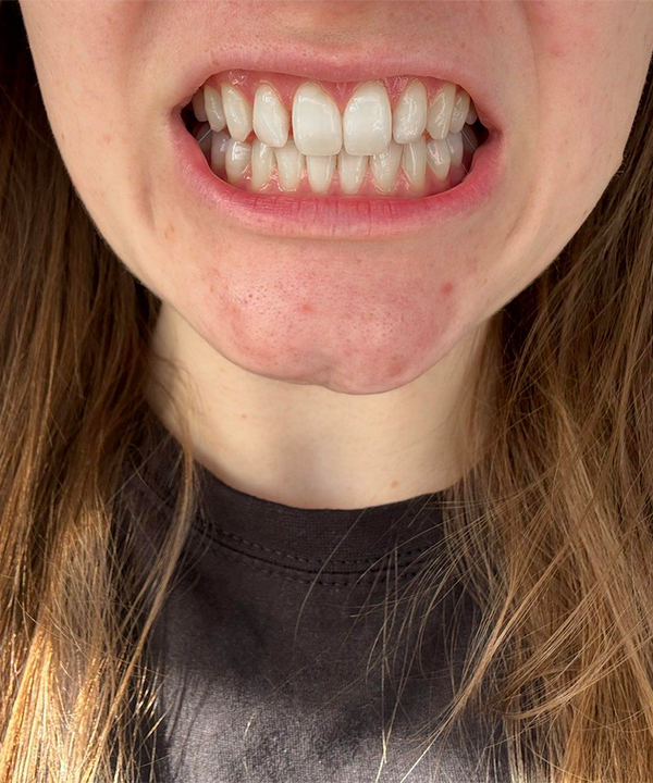 Customer smile result