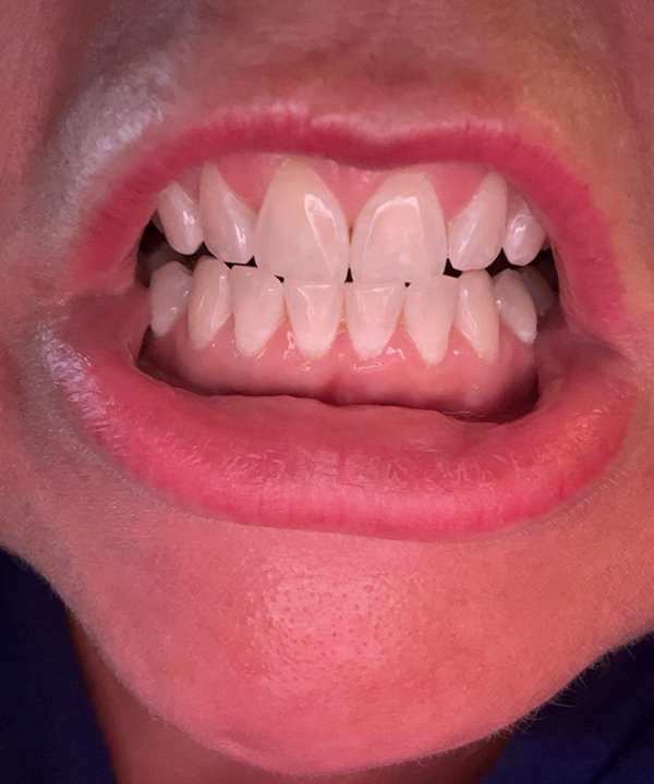 Customer smile result