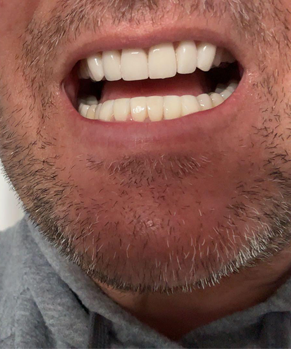 Customer smile result