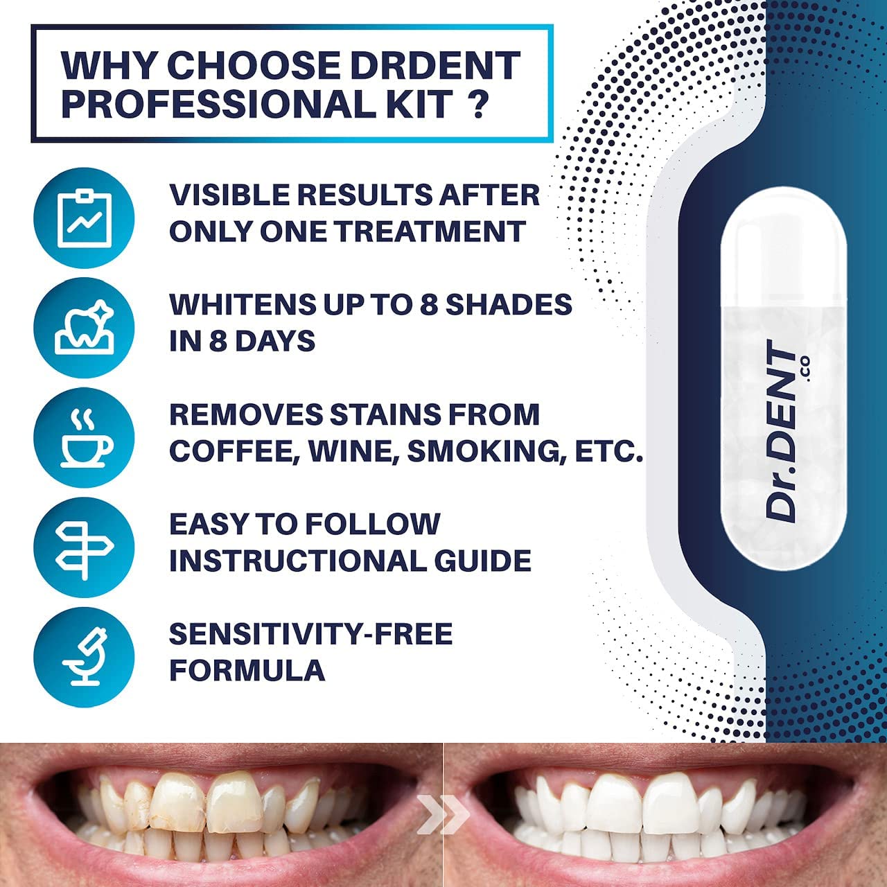 DrDent Professional LED Teeth Whitening Kit